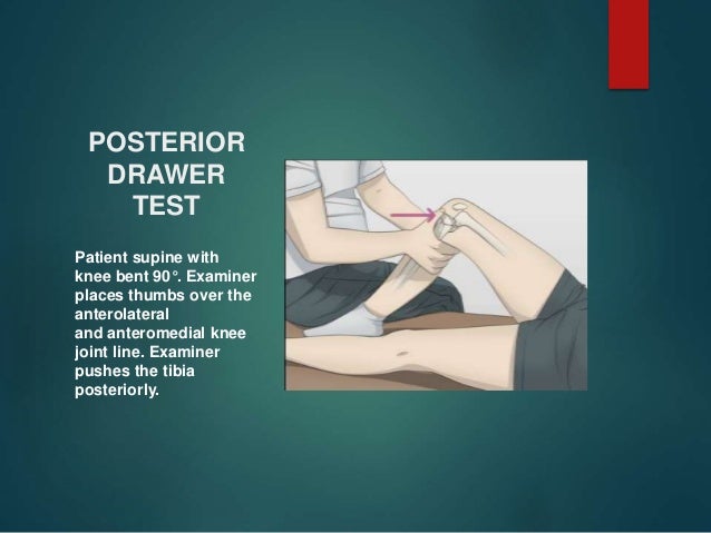 Special Tests Of Knee Joint