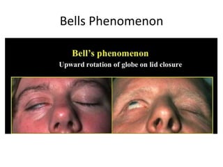 Special Tests in musculoskeletal physiotherapy.pptx