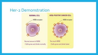 Her-2 Demonstration
 
