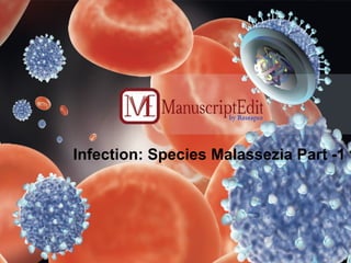 Infection: Species Malassezia Part -1 
 