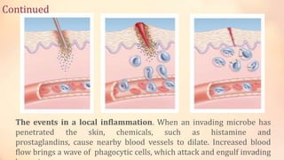 Continued
10
The events in a local inflammation. When an invading microbe has
penetrated the skin, chemicals, such as histamine and
prostaglandins, cause nearby blood vessels to dilate. Increased blood
flow brings a wave of phagocytic cells, which attack and engulf invading
 