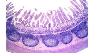 Specific causes of peritonitis