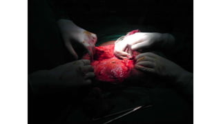 Specific causes of peritonitis