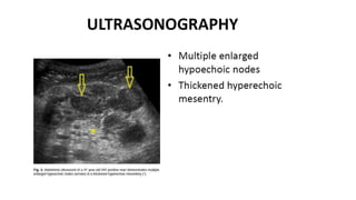 Specific causes of peritonitis
