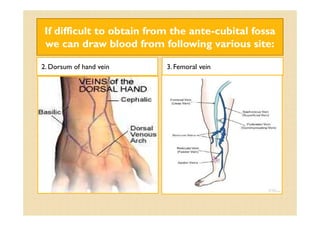 If difficult to obtain from the anteIf difficult to obtain from the ante--cubitalcubital fossafossa
we can draw blood from following various site:we can draw blood from following various site:
2. Dorsum of hand vein 3. Femoral vein
 
