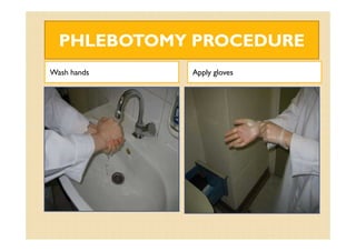 PHLEBOTOMY PROCEDUREPHLEBOTOMY PROCEDURE
Wash hands Apply gloves
 