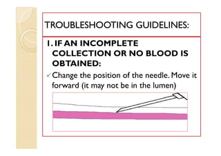 TROUBLESHOOTING GUIDELINES:TROUBLESHOOTING GUIDELINES:
1. IF AN INCOMPLETE
COLLECTION OR NO BLOOD IS
OBTAINED:
Change the position of the needle. Move it
forward (it may not be in the lumen)
1. IF AN INCOMPLETE
COLLECTION OR NO BLOOD IS
OBTAINED:
Change the position of the needle. Move it
forward (it may not be in the lumen)
 