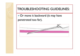  Or move it backward (it may have
penetrated too far).
TROUBLESHOOTING GUIDELINES:TROUBLESHOOTING GUIDELINES:
 