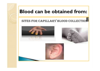 Blood can be obtained from:Blood can be obtained from:
 
