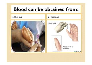 Blood can be obtained from:Blood can be obtained from:
1. Heel pulp 2. Finger pulp
 