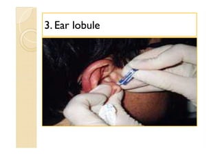 33. Ear lobule. Ear lobule
 