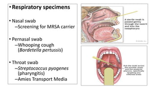 Mrsa Sample Collection Specimen collection for clinical microbiology laboratory | PPTX