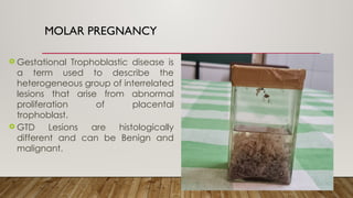 Comprehensive Overview of Molar and Ectopic Pregnancies with Placental ...