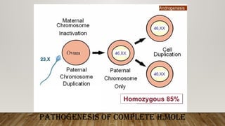 Comprehensive Overview of Molar and Ectopic Pregnancies with Placental ...