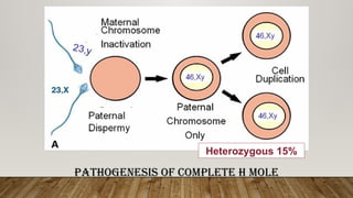 Comprehensive Overview of Molar and Ectopic Pregnancies with Placental ...