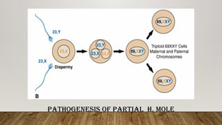 Comprehensive Overview of Molar and Ectopic Pregnancies with Placental ...