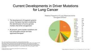 Relative Frequency of Lung Adenocarcinoma
Oncogene Drivers2
• The development of targeted systemic
cancer therapies has been enabled by
the identification of tumor genetic
markers that drive oncogenesis1
• At present, some marker mutations are
not actionable and do not have
approved therapies1
Current Developments in Driver Mutations
for Lung Cancer
AKT = v-akt murine thymoma viral oncogene; ALK = anaplastic lymphoma kinase; BRAF =
B-Raf proto-oncogene, serine/threonine kinase; EGFR = epidermal growth factor receptor; HER2 = human epidermal growth
factor receptor 2; HRAS = Harvey Rat Sarcoma Viral Oncogene Homolog; KRAS = Kirsten rat sarcoma viral oncogene
homolog; MAP3K1 = mitogen-activated protein triple kinase 1; MET = mesenchymal-to-epithelial transition factor; NRAS =
neuroblastoma RAS viral (v-ras) oncogene homolog; NTRK1 = non-receptor tyrosine kinase 1; PIK3CA = phosphatidylinositol-
4,5-bisphosphate 3-kinase, catalytic subunit alpha; RET = ret proto-oncogene; ROS1 = ROS proto-oncogene 1, receptor
tyrosine kinase.
1. Blakely CM, Bivona TG. Cancer Discov. 2012;2(10):872–875. 2. Bubendorf L et al.
Eur Respir Rev. 2017;26:17.0007. Image adapted from Bubendorf L et al. Eur Respir Rev. 2017;26:17.0007.
25%
10%
4%
1.9%
0.9%
1%
3%
3%
2%
1%
1%
1%
3%
1%
42%
KRAS
EGFR
ALK
ROS1
RET
NTRK1
HER2
BRAF
PI3KCA
HRAS
NRAS
AKT
MET exon 14
MAP3K1
Unknown
Unknown
KRAS
EGFR
ALK
 