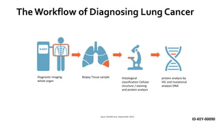 TheWorkflow of Diagnosing Lung Cancer
Ipsos HealthCare, September 2015
ID-KEY-00090
Diagnostic imaging
whole organ
Biopsy Tissue sample Histological
classification Cellular
structure / staining
and protein analysis
protein analysis by
IHC and mutational
analysis DNA
 
