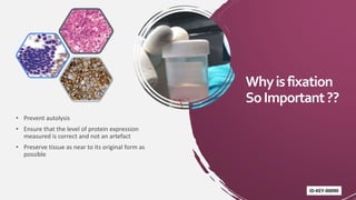 Whyisfixation
SoImportant??
• Prevent autolysis
• Ensure that the level of protein expression
measured is correct and not an artefact
• Preserve tissue as near to its original form as
possible
ID-KEY-00090
 