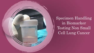 Specimen Handling
in Biomarker
Testing Non Small
Cell Lung Cancer
 