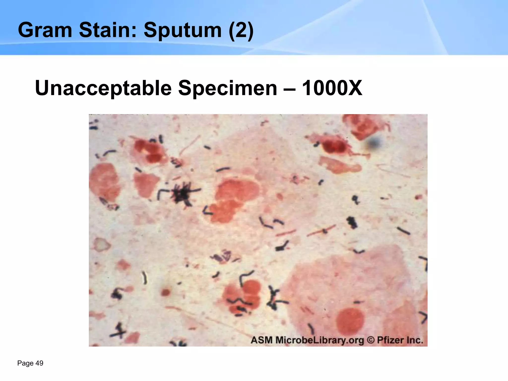 Page 49
Gram Stain: Sputum (2)
Unacceptable Specimen – 1000X
 
