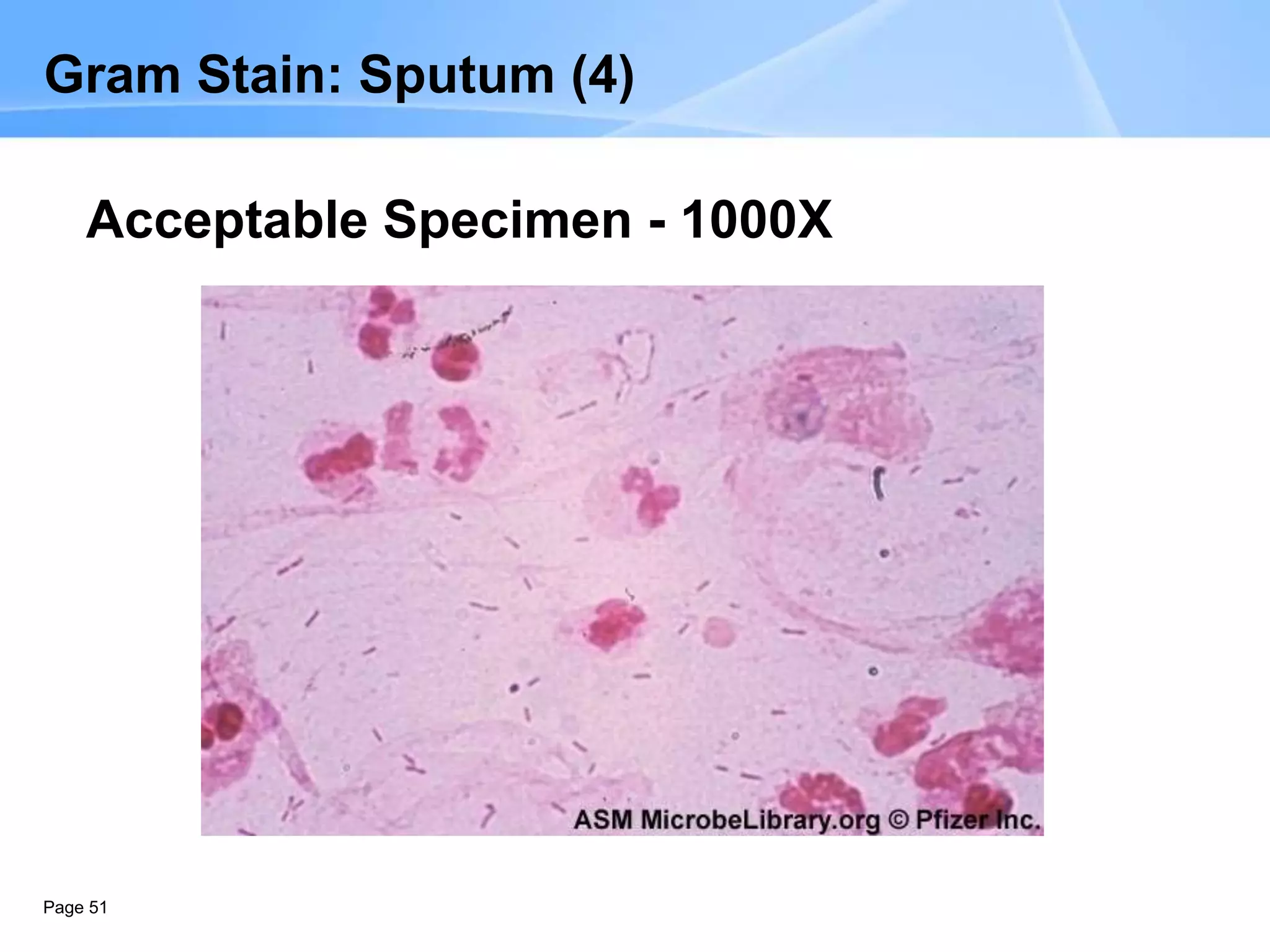 Page 51
Gram Stain: Sputum (4)
Acceptable Specimen - 1000X
 