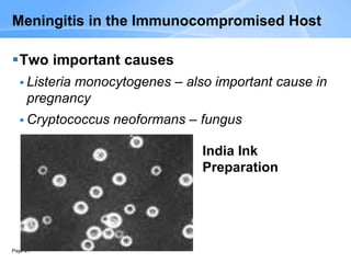 Page 21
Meningitis in the Immunocompromised Host
Two important causes
 Listeria monocytogenes – also important cause in
pregnancy
 Cryptococcus neoformans – fungus
India Ink
Preparation
 