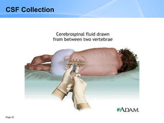 Page 22
CSF Collection
 