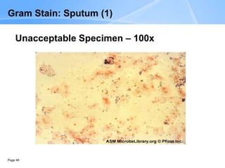 Page 48
Gram Stain: Sputum (1)
Unacceptable Specimen – 100x
 