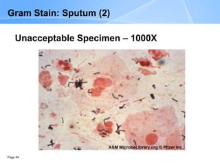 Page 49
Gram Stain: Sputum (2)
Unacceptable Specimen – 1000X
 