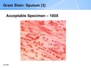 Page 50
Page  50
Gram Stain: Sputum (3)
Acceptable Specimen – 100X
 