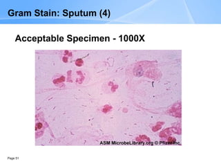 Page 51
Gram Stain: Sputum (4)
Acceptable Specimen - 1000X
 