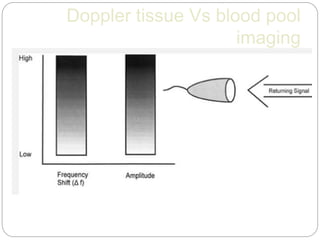 Doppler tissue Vs blood pool
imaging
 