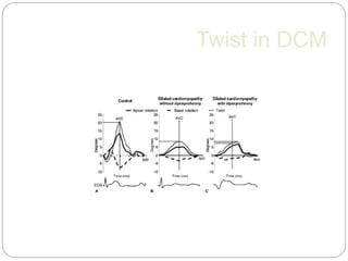 Twist in DCM
Am J Cardiol 2008;101:1163–1169, 2008
 