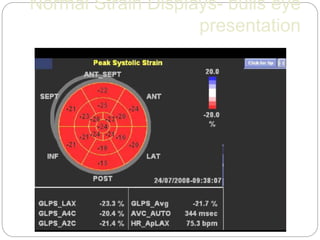 Normal Strain Displays- bulls eye
presentation
 