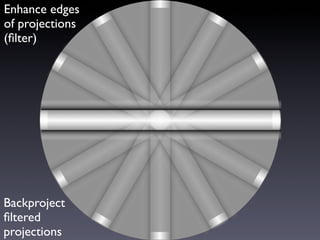 Round Shape Spect SPECT | PDF