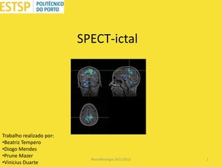 SPECT-ictal

Trabalho realizado por:
•Beatriz Tempero
•Diogo Mendes
•Prune Mazer
•Vinicius Duarte

Neurofisiologia 2011/2012

1

 