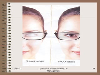 03:58 PM Spectacle Intolerance and its
Management
64
 