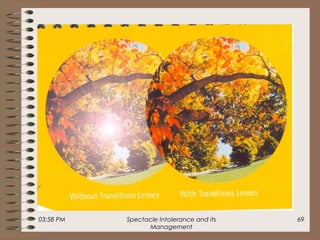 03:58 PM Spectacle Intolerance and its
Management
69
 