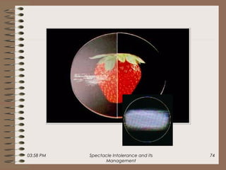 03:58 PM Spectacle Intolerance and its
Management
74
 