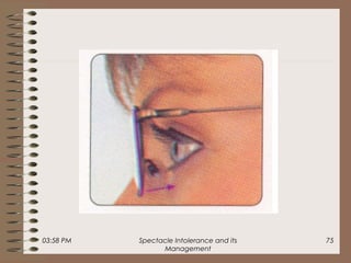 03:58 PM Spectacle Intolerance and its
Management
75
 