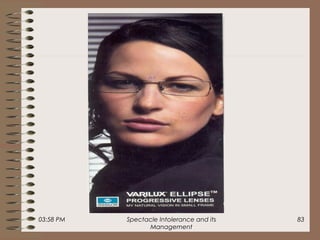 03:58 PM Spectacle Intolerance and its
Management
83
 