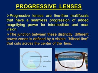 PROGRESSIVE LENSES
Progressive lenses are line-free multifocals
that have a seamless progression of added
magnifying power for intermediate and near
vision.
The junction between these distinctly different
power zones is defined by a visible "bifocal line"
that cuts across the center of the lens.
 