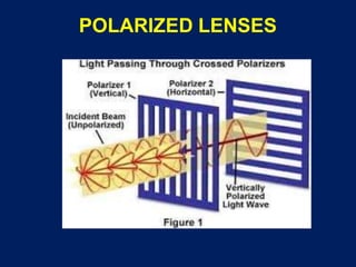 POLARIZED LENSES
 