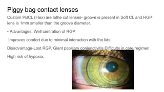 Piggyback Rgp Spectacles and contact lenses presentation.pptx