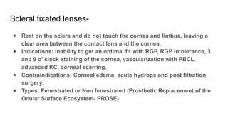 Spectacles and contact lenses presentation.pptx
