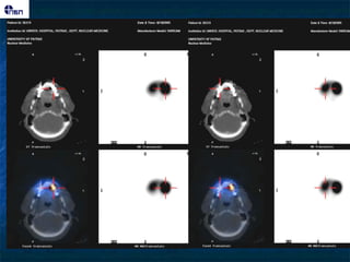 ΢ογθεκηνώζεηξ ζημ ζηόμα
 