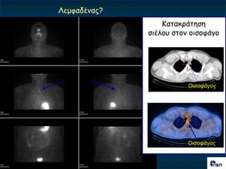 Λεμθαδέκαξ?
                  Καηαθνάηεζε
              ζηέιμο ζημκ μηζμθάγμ




                         Οηζοθάγος




                         Οηζοθάγος
 