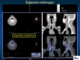 Γμβνοσθό οπόιεημμα;




Σρατειηθός ιεκθαδέλας
 
