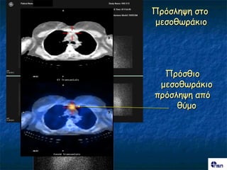 Πνόζιερε ζημ
μεζμζςνάθημ




  Πνόζζημ
 μεζμζςνάθημ
πνόζιερε από
     ζύμμ
 